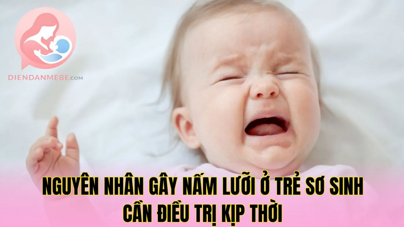Nguyên nhân gây nấm lưỡi ở trẻ sơ sinh cần điều trị kịp thời