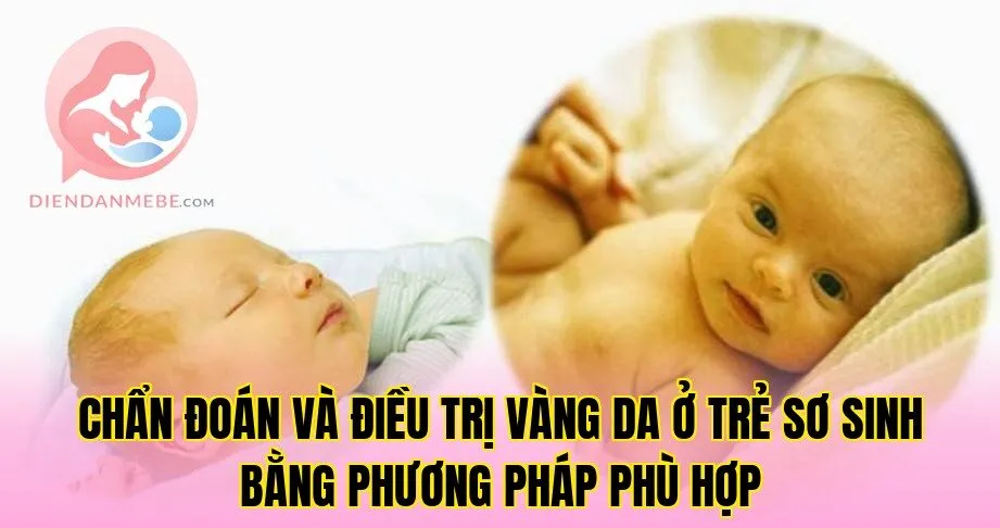 Chẩn đoán và điều trị vàng da ở trẻ sơ sinh bằng phương pháp phù hợp
