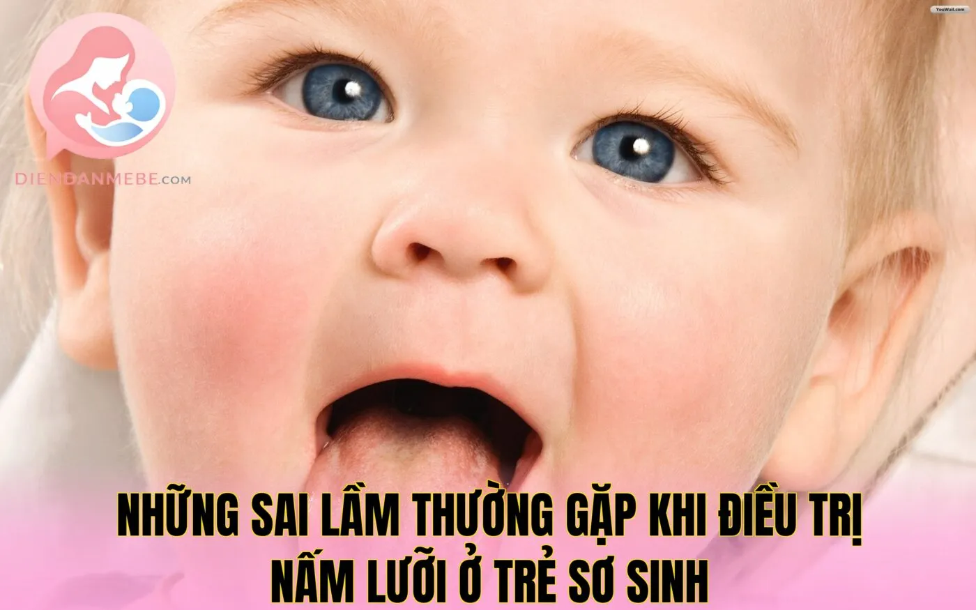 Những sai lầm thường gặp khi điều trị nấm lưỡi ở trẻ sơ sinh