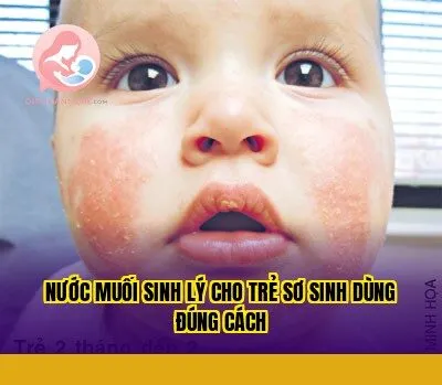Nước muối sinh lý cho trẻ sơ sinh dùng đúng cách