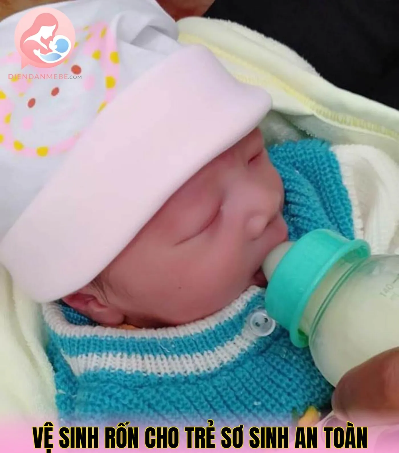 Vệ Sinh Rốn Cho Trẻ Sơ Sinh An Toàn