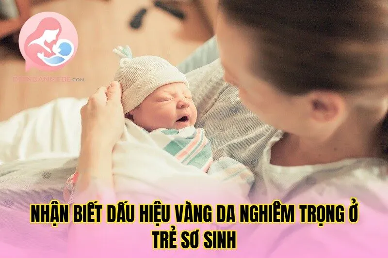Nhận biết dấu hiệu vàng da nghiêm trọng ở trẻ sơ sinh