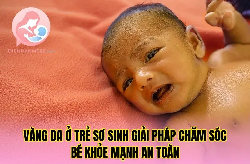 Vàng Da Ở Trẻ Sơ Sinh Giải Pháp Chăm Sóc Bé Khỏe Mạnh An Toàn