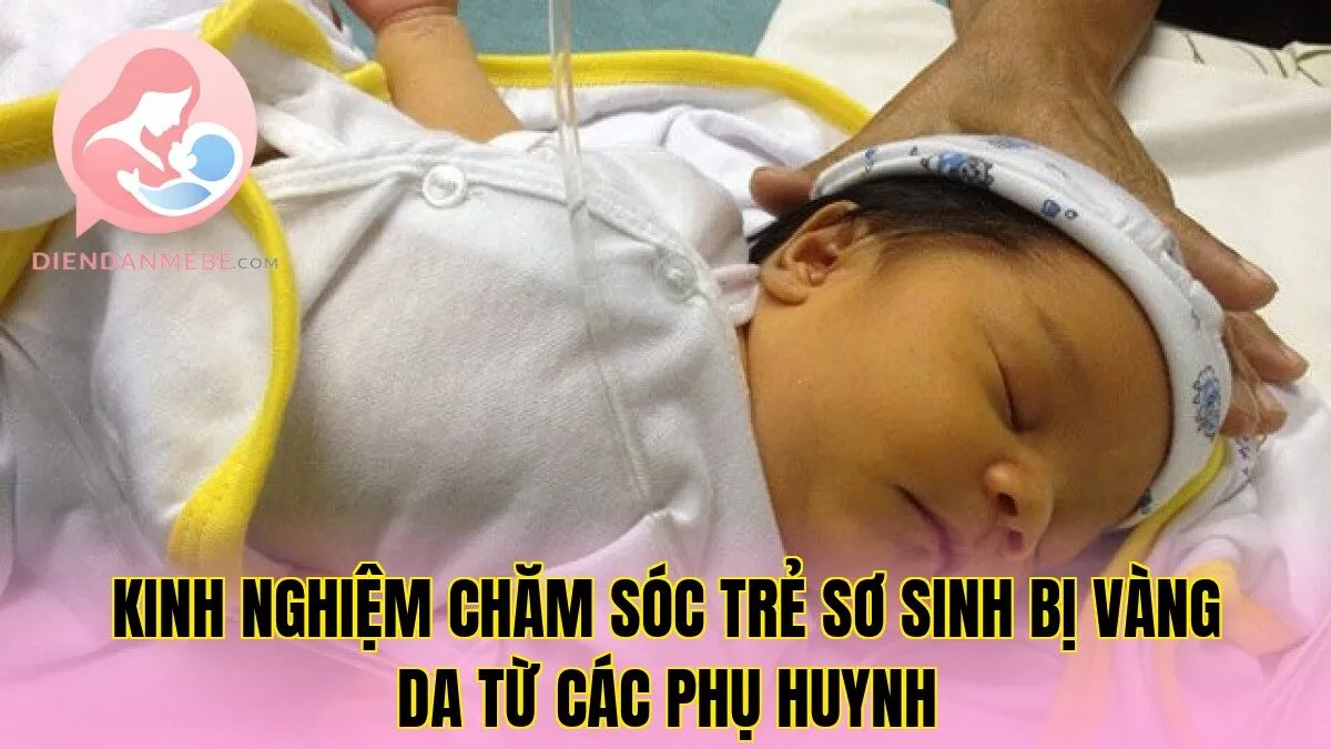Kinh nghiệm chăm sóc trẻ sơ sinh bị vàng da từ các phụ huynh