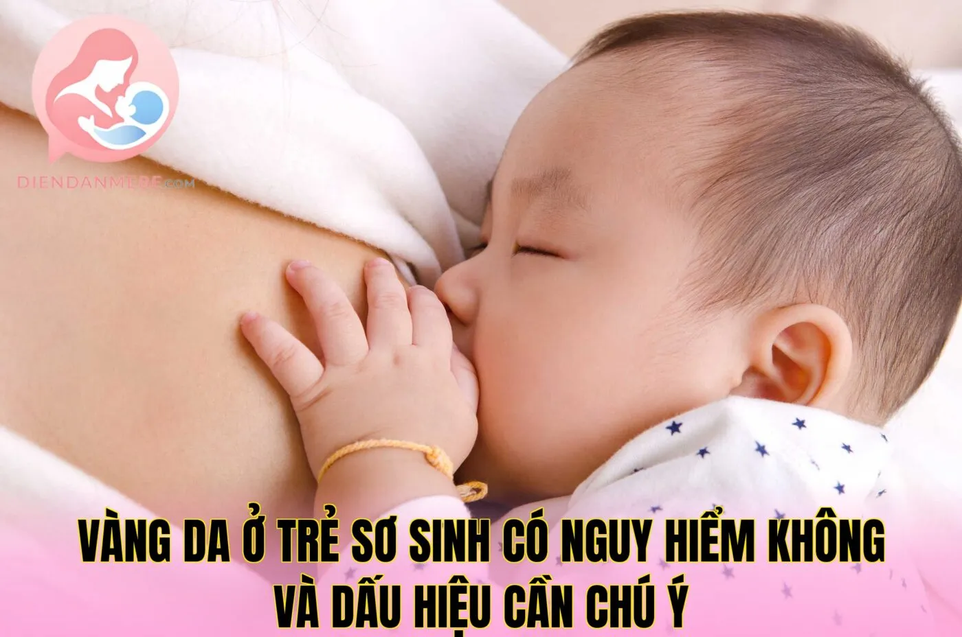 Vàng da ở trẻ sơ sinh có nguy hiểm không và dấu hiệu cần chú ý