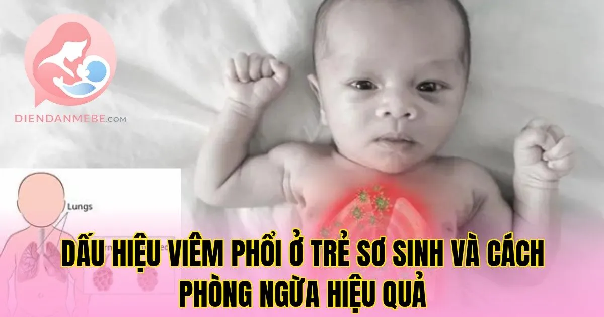 Dấu Hiệu Viêm Phổi Ở Trẻ Sơ Sinh Và Cách Phòng Ngừa Hiệu Quả