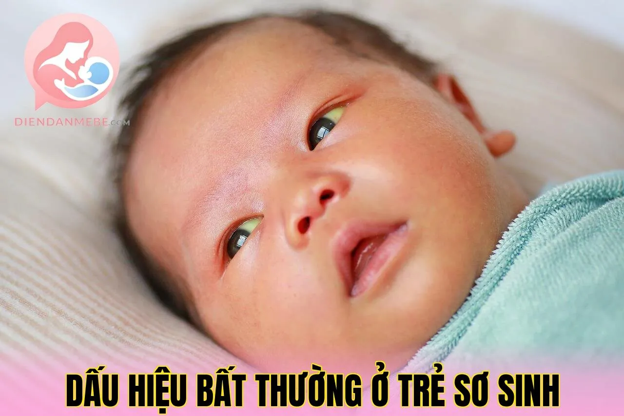 Dấu Hiệu Bất Thường Ở Trẻ Sơ Sinh