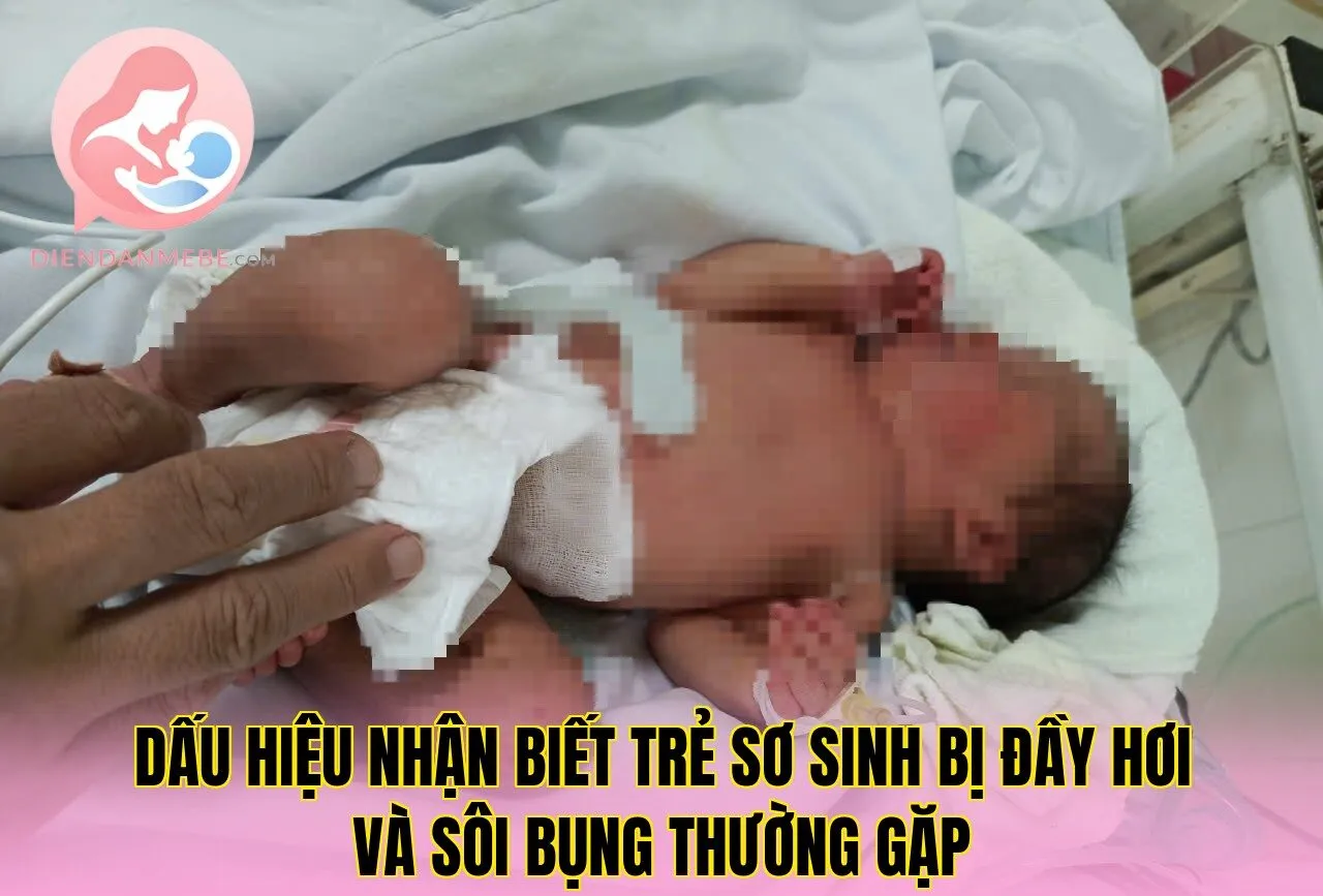 Dấu hiệu nhận biết trẻ sơ sinh bị đầy hơi và sôi bụng thường gặp