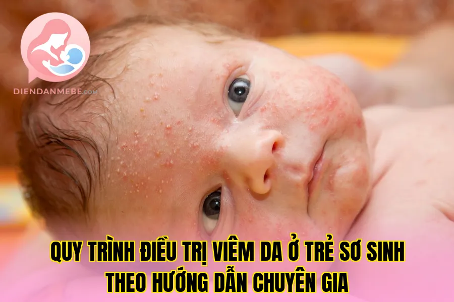 Quy trình điều trị viêm da ở trẻ sơ sinh theo hướng dẫn chuyên gia