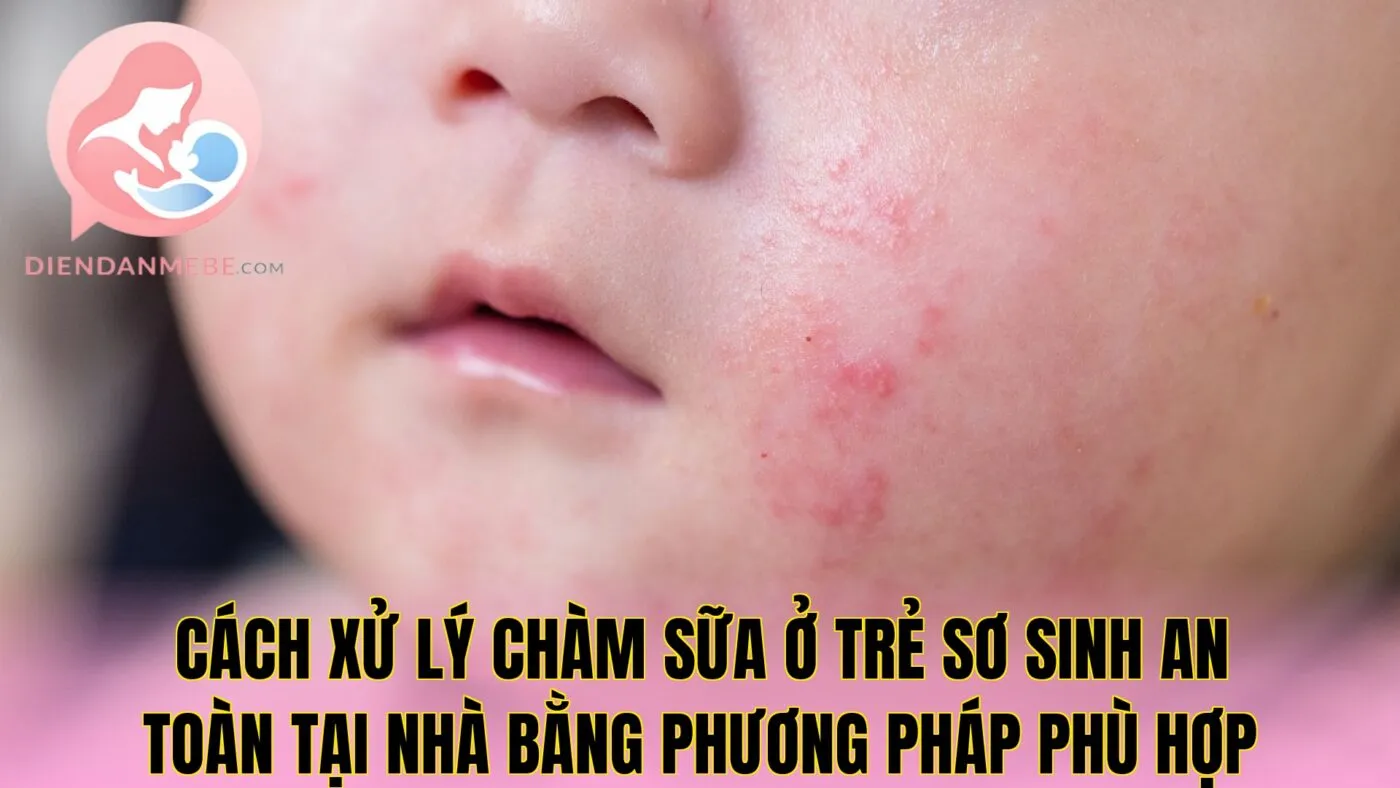 Cách xử lý chàm sữa ở trẻ sơ sinh an toàn tại nhà bằng phương pháp phù hợp