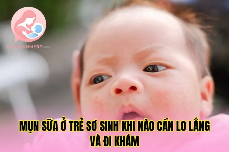 Mụn Sữa Ở Trẻ Sơ Sinh Khi Nào Cần Lo Lắng Và Đi Khám