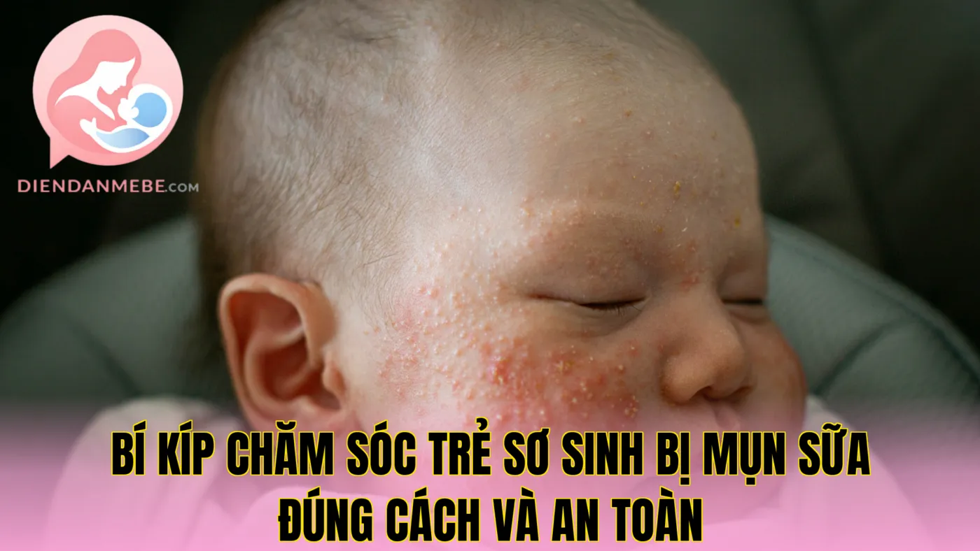 Bí kíp chăm sóc trẻ sơ sinh bị mụn sữa đúng cách và an toàn