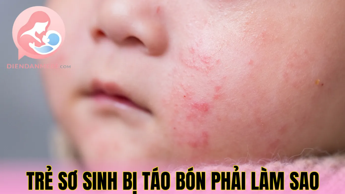Trẻ Sơ Sinh Bị Táo Bón Phải Làm Sao