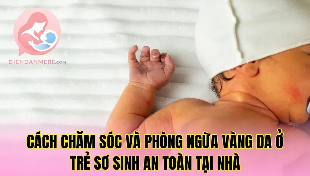 Cách chăm sóc và phòng ngừa vàng da ở trẻ sơ sinh an toàn tại nhà