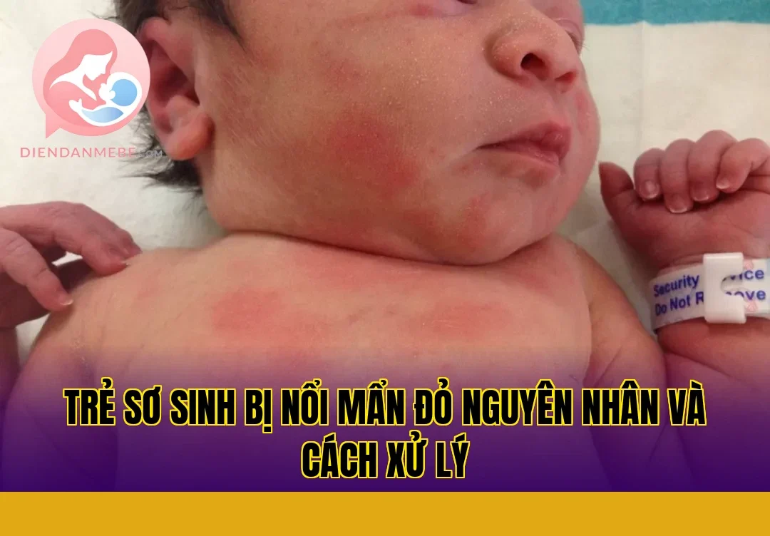 Trẻ sơ sinh bị nổi mẩn đỏ nguyên nhân và cách xử lý