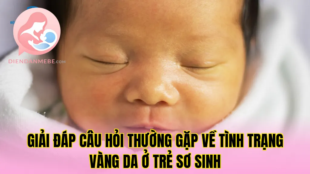 Giải đáp câu hỏi thường gặp về tình trạng vàng da ở trẻ sơ sinh