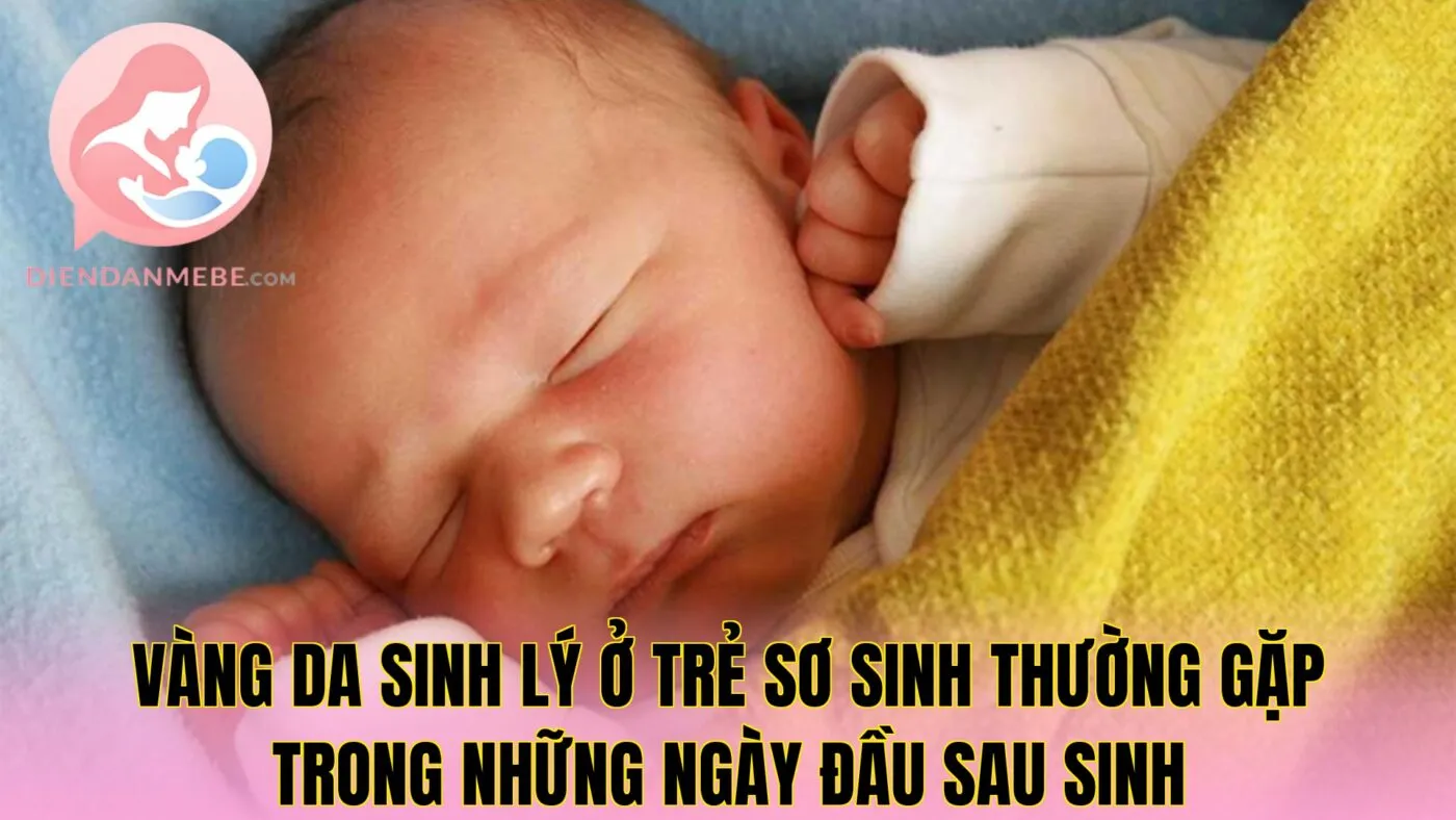Vàng da sinh lý ở trẻ sơ sinh thường gặp trong những ngày đầu sau sinh