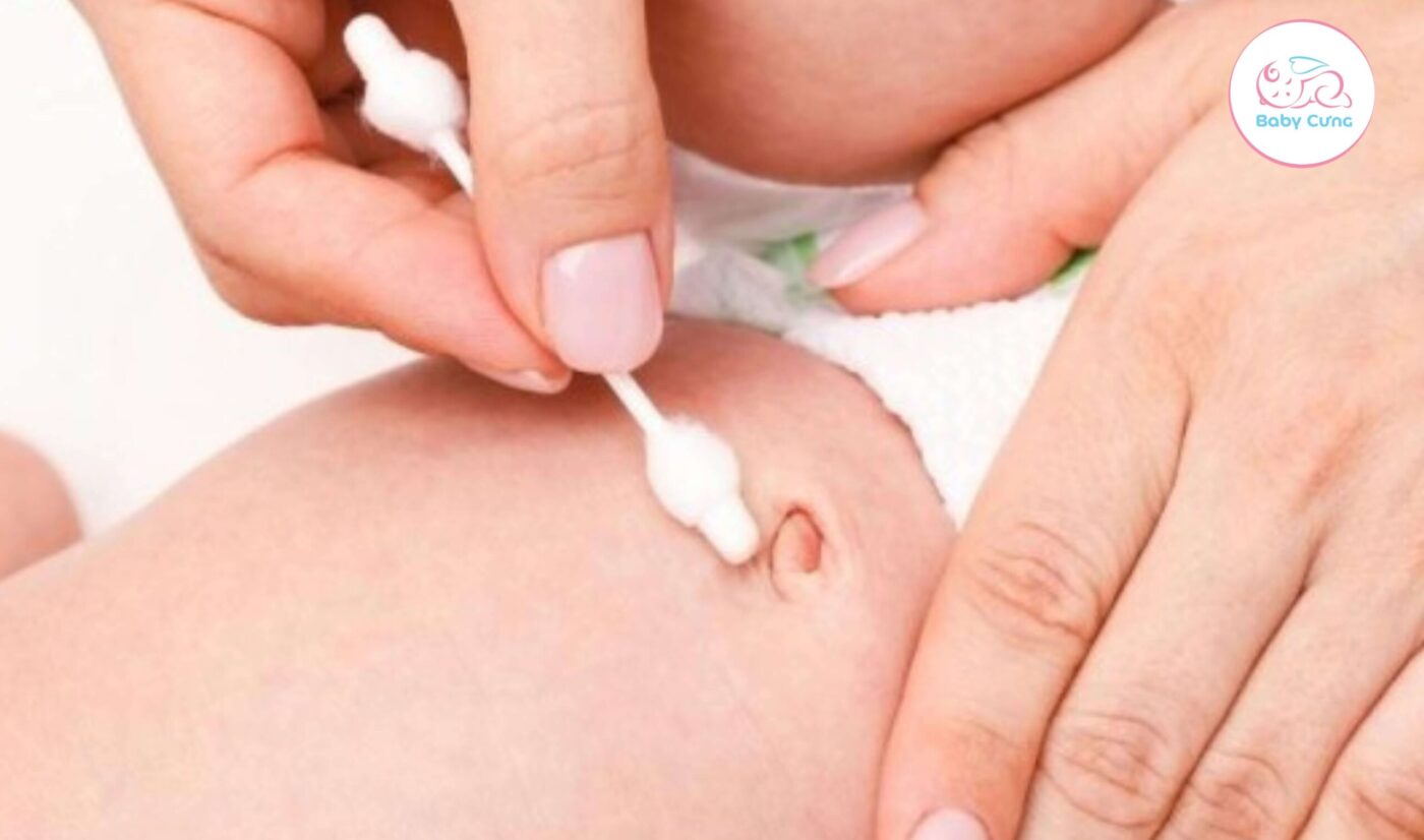 vệ sinh rốn em bé